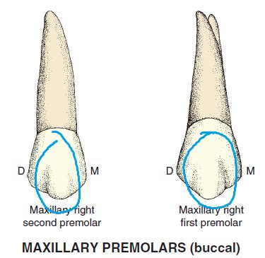 difference between maxillary 1st and 2nd molar|Differences between Maxillary 1st & 2nd Premolar .